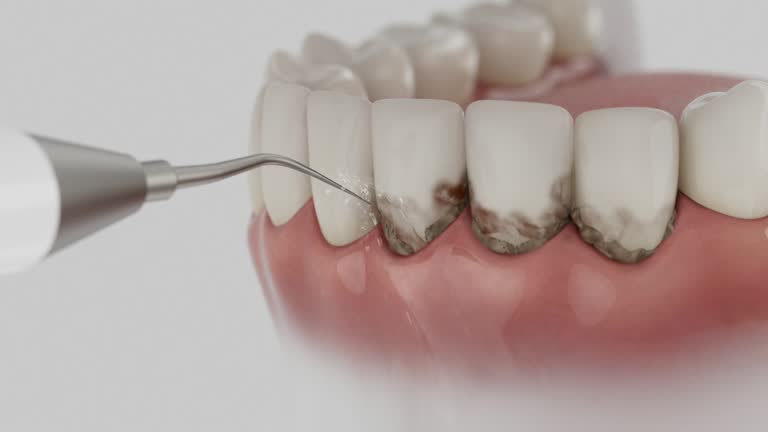 Reliable Dental contractor in Crystal Falls, MI by Dentist Open Now